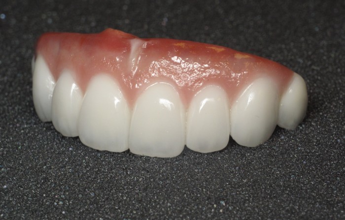 dental implants Paramount CA